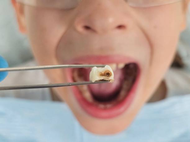 Best Same-Day Emergency Dental Services in Campbelltown, PA